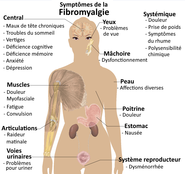 Le Curcuma : Un Allié Naturel pour Soulager la Fibromyalgie